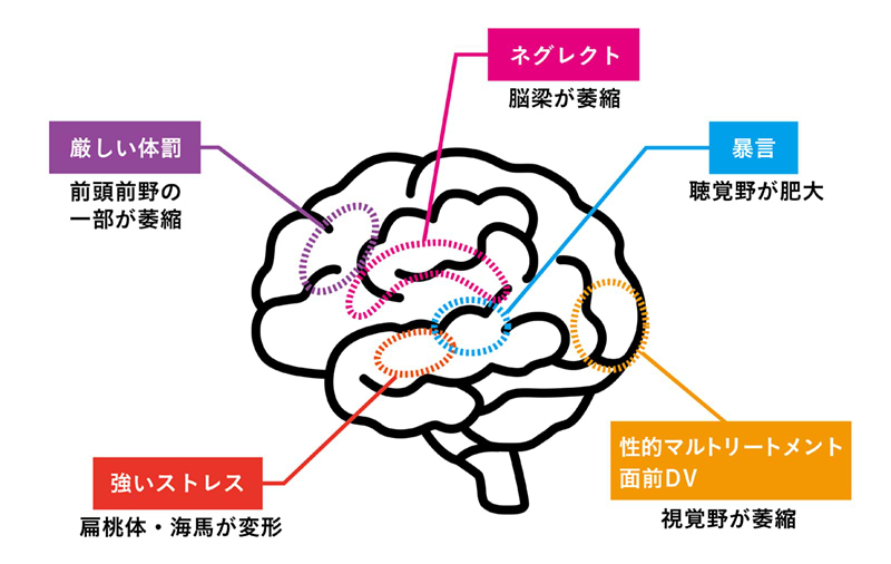 脳の図