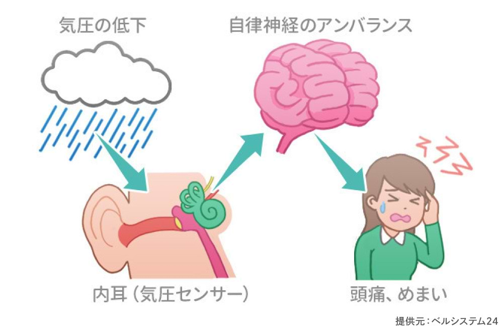 気圧と頭痛